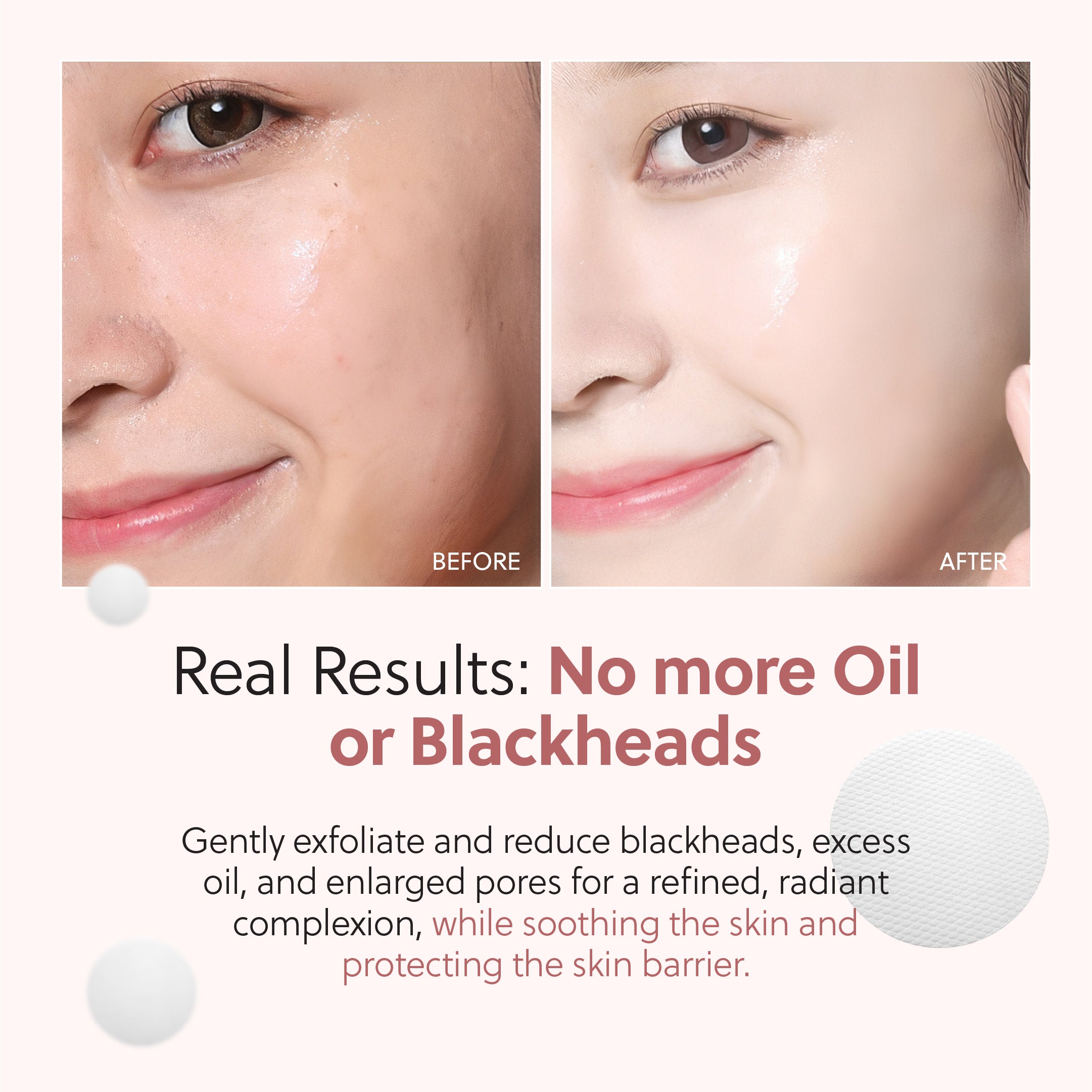 Zero Pore Pads