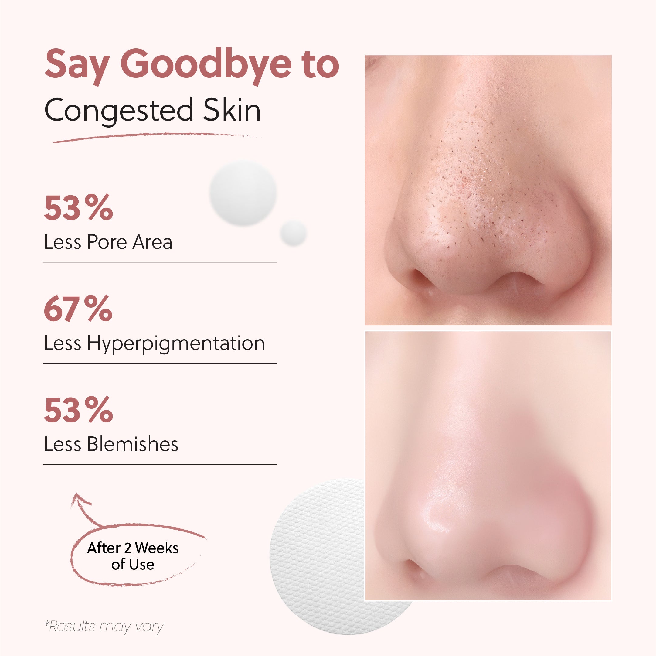 Zero Pore Pads