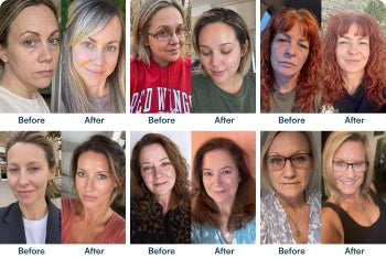 Six pairs of before and after skin appearance photos