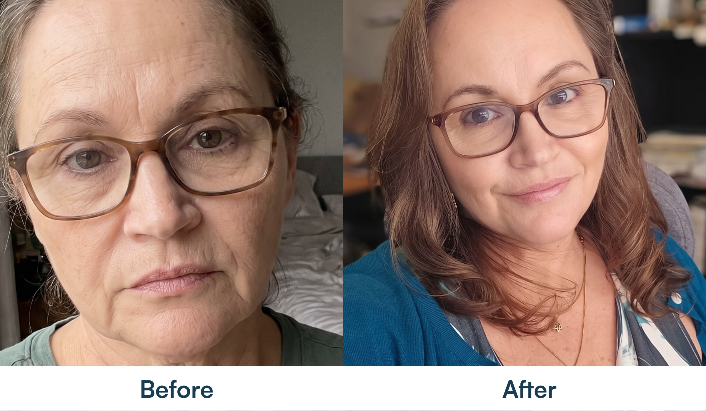Before and after skin appearance comparison