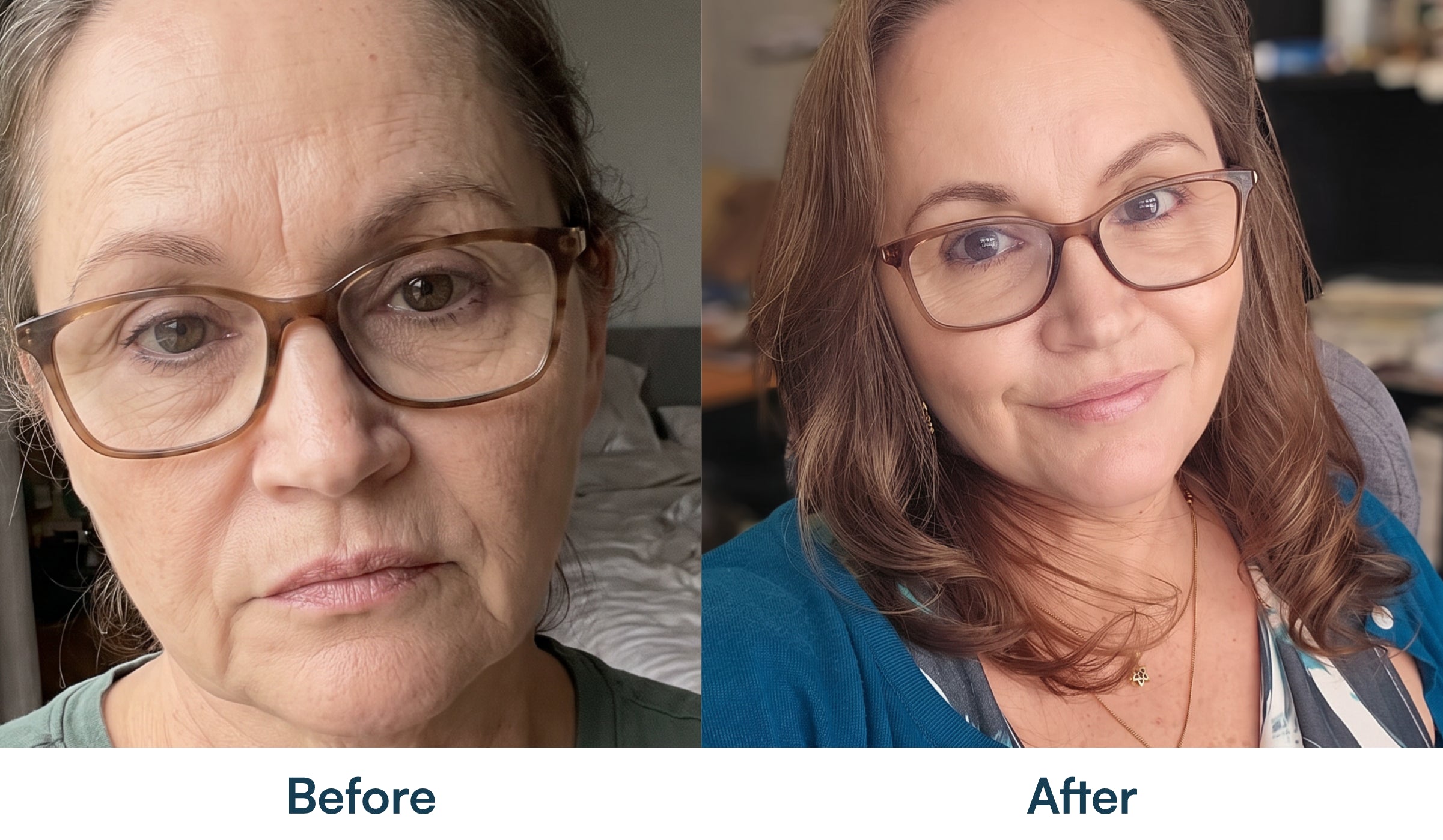Before and after skin appearance comparison