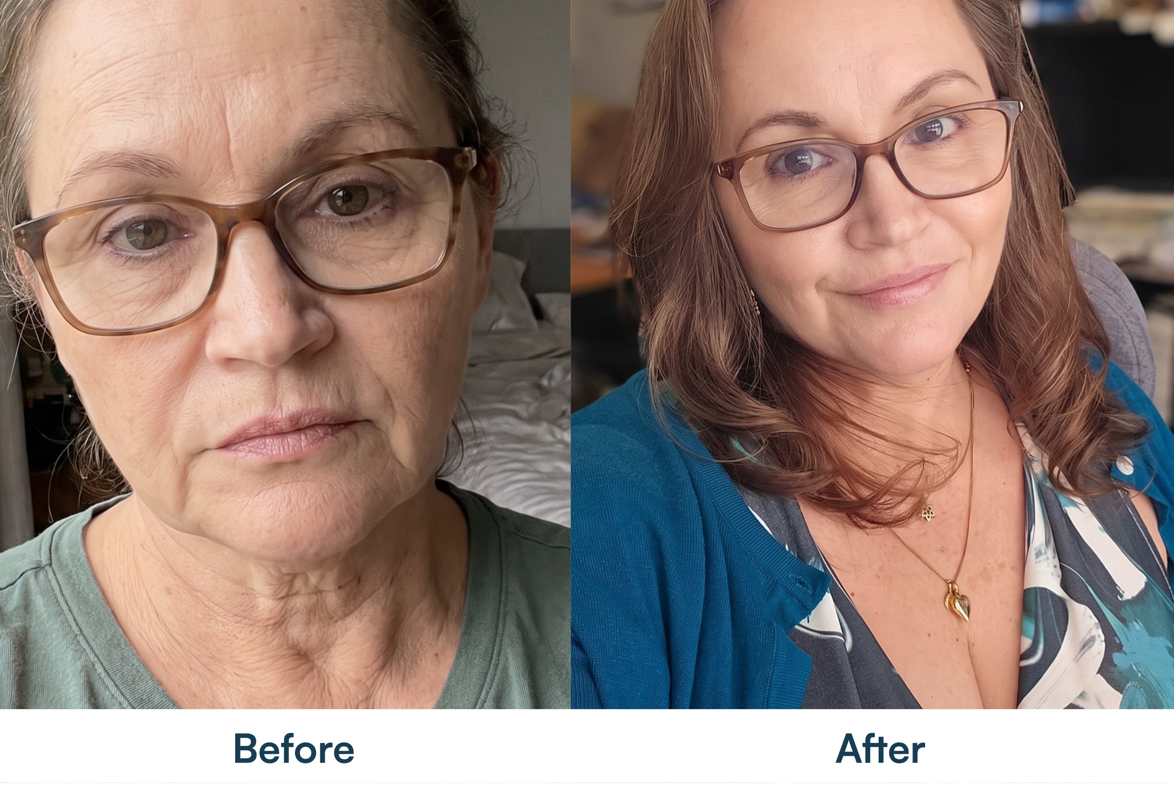 Before and after skin appearance comparison