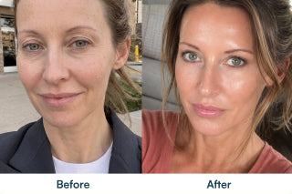 Before and after comparison; individual results may vary