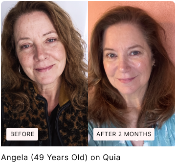 Before and after skin comparison, with original labels