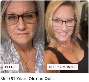 Before and after skin comparison, with original labels