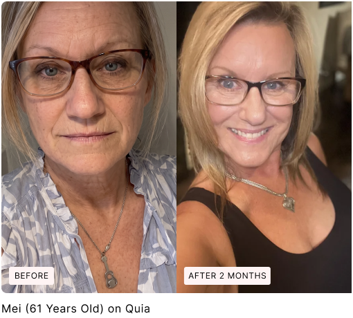 Before and after skin comparison, with original labels