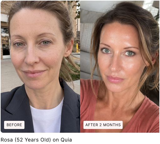 Before and after skin comparison, with original labels