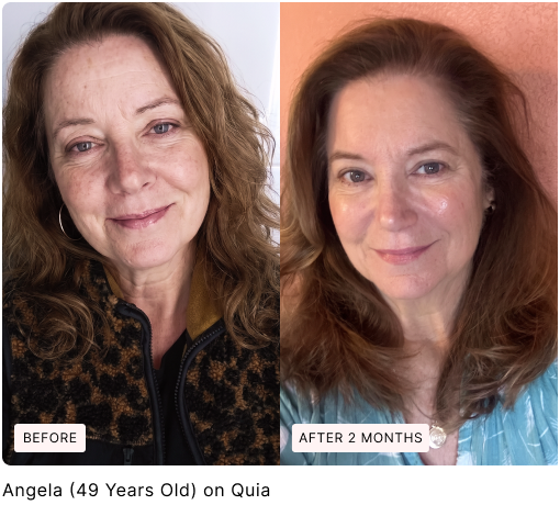 Before and after skin comparison, with original labels