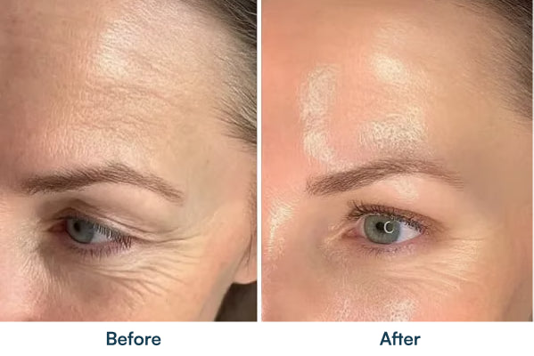 Before and after skin comparison