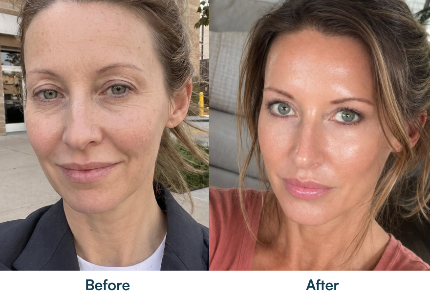 Before and after skin photographs
