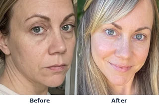 Before and after comparison; individual results may vary