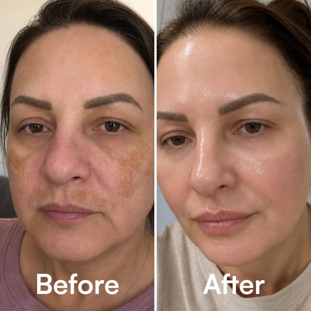Quia Turmeric & Kojic Acid Overnight Mask