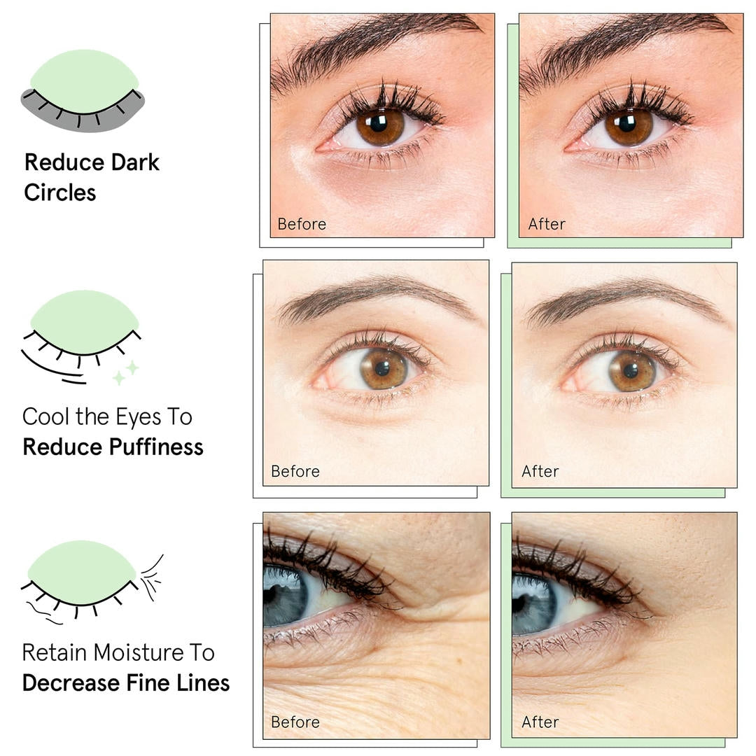 Quia Collagen Eye Patches