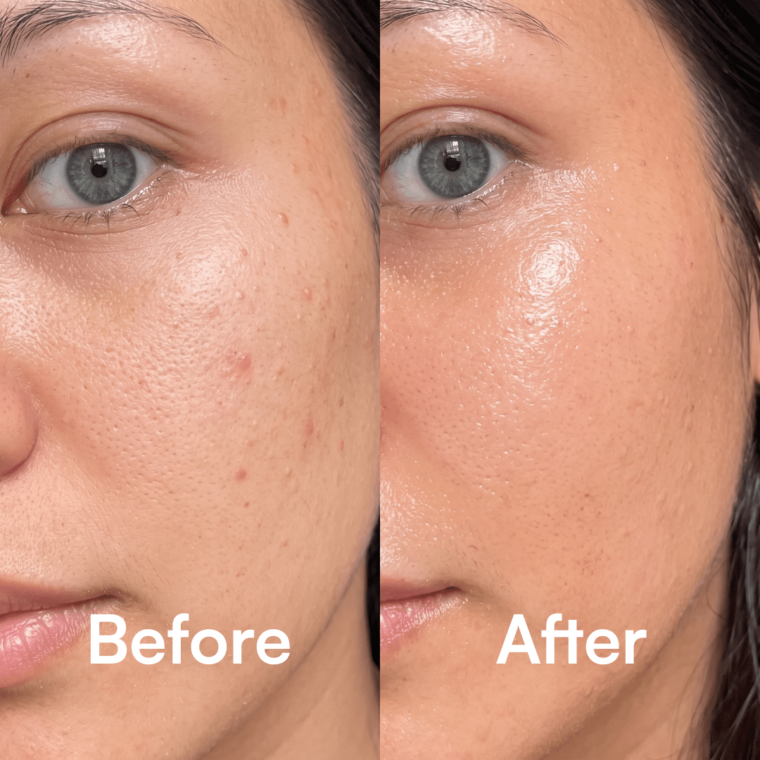 QUIA Collagen + Niacinamide Jelly Cream - Quia Korean Beauty