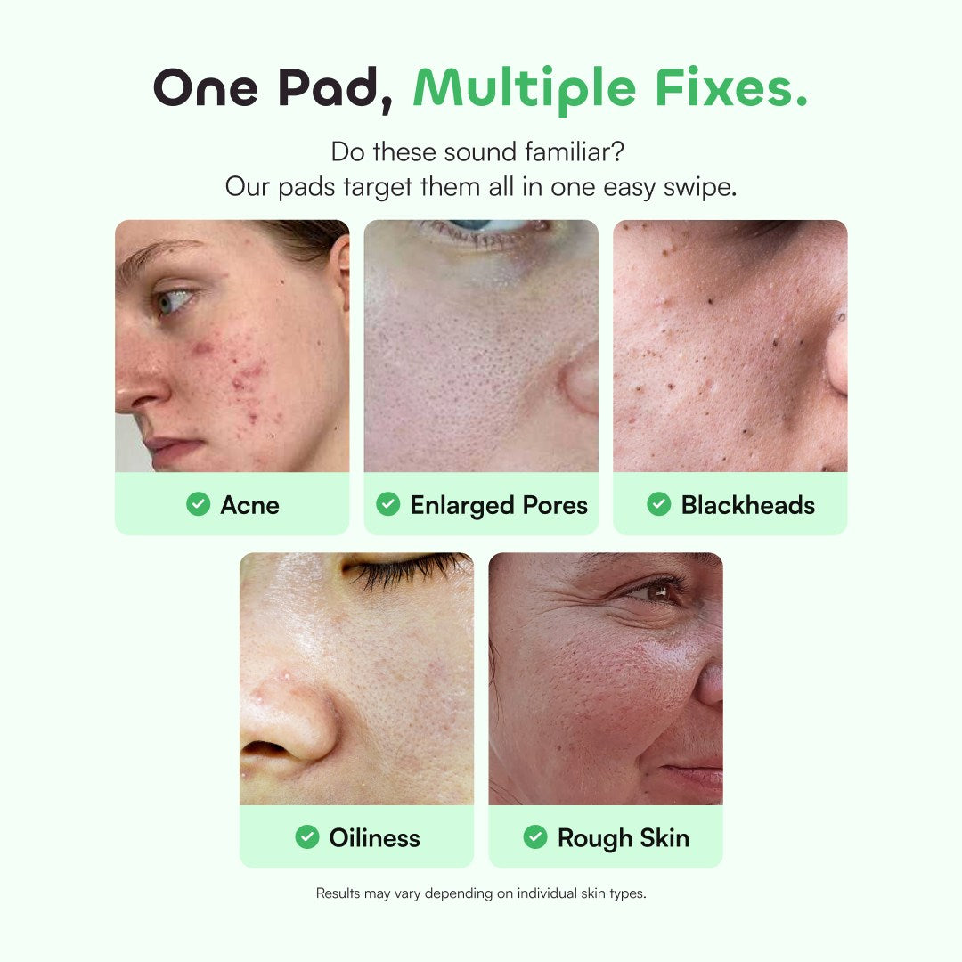QUIA No More Pore Pads - Quia Korean Beauty