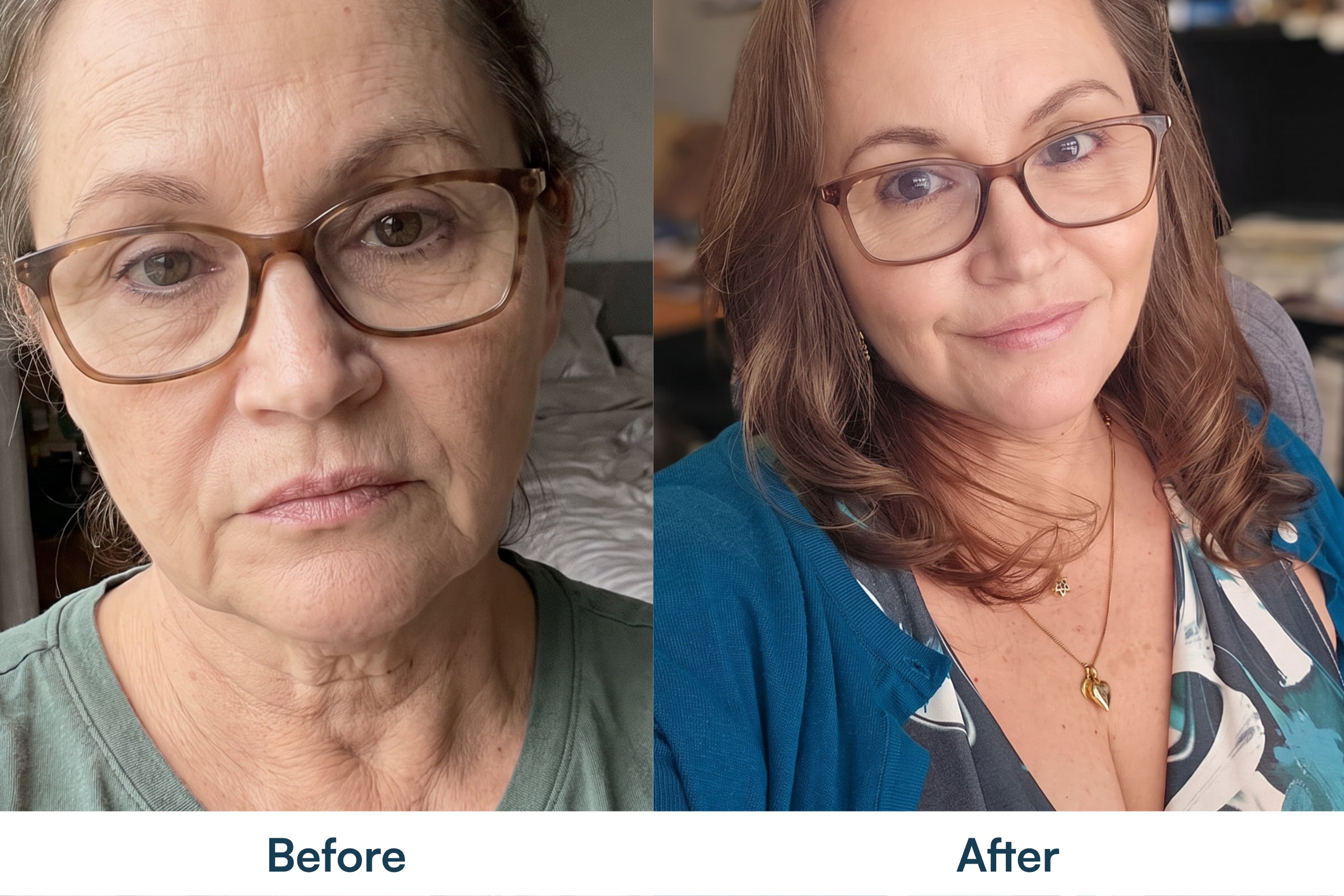 Before and after skin appearance comparison