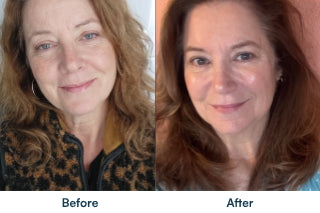 Before and after comparison; individual results may vary