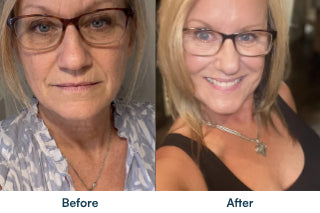 Before and after comparison; individual results may vary