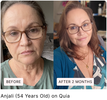 Before and after skin comparison, with original labels