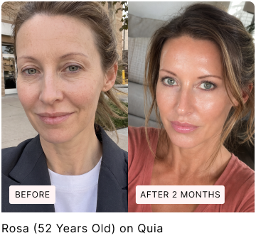 Before and after skin comparison, with original labels