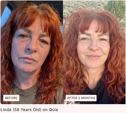 Before and after skin comparison, with original labels