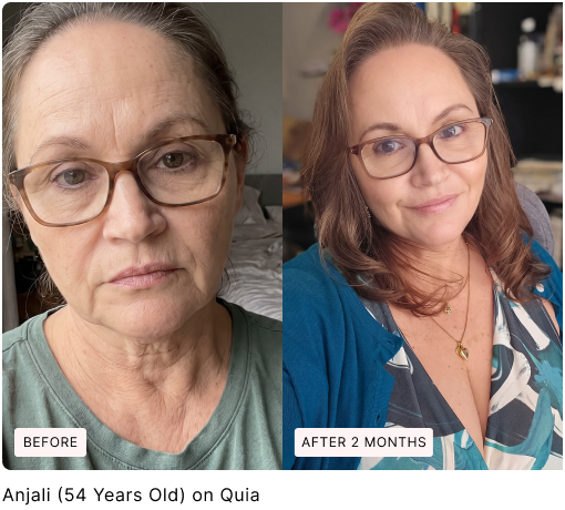 Before and after skin comparison, with original labels
