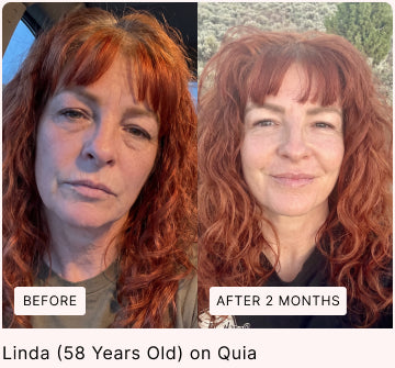 Before and after skin comparison, with original labels