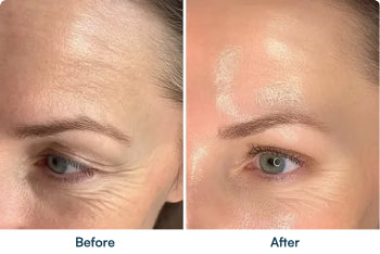 Before and after skin comparison