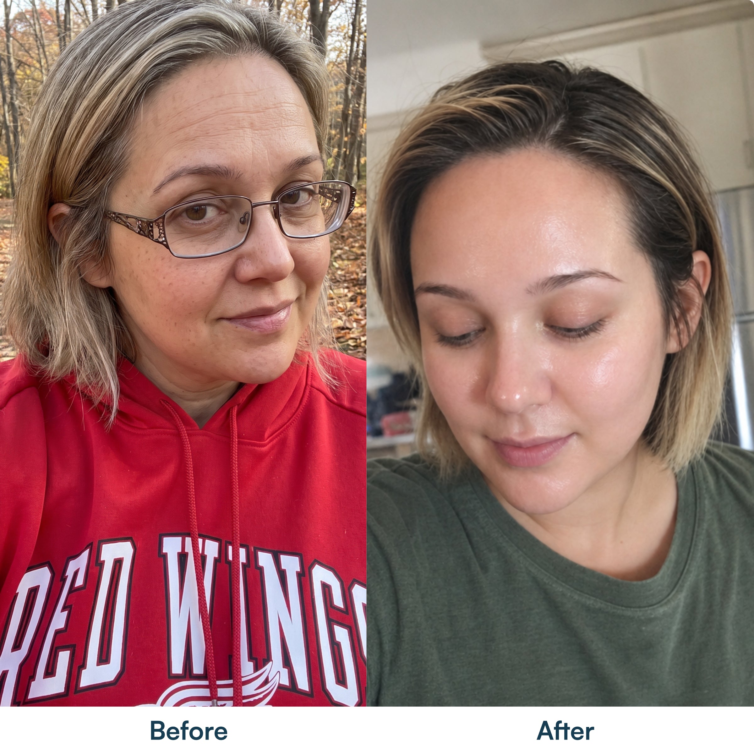Customer before and after using Quia Collagen Night Wrapping Mask; individual results may vary
