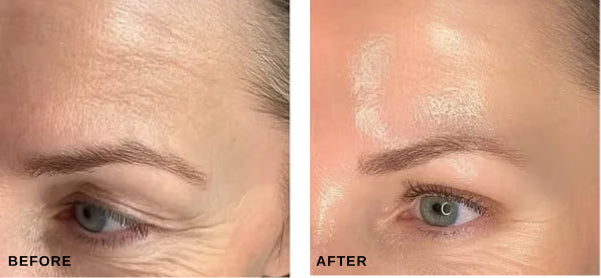 Before and after comparison; individual results may vary
