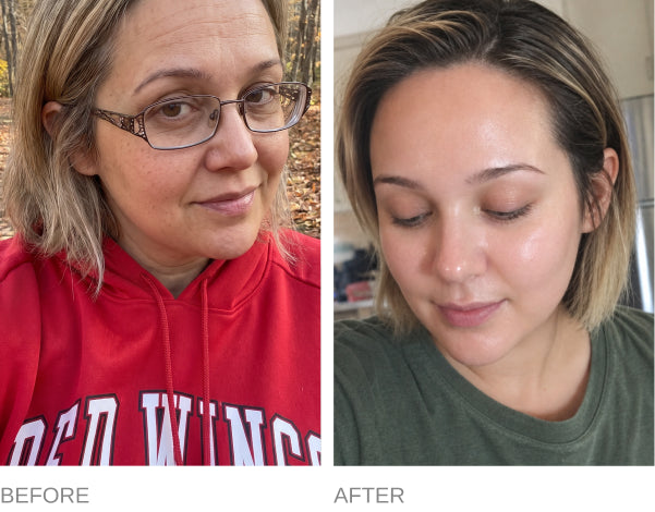 Before and after comparison; individual results may vary