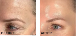 Before and after comparison; individual results may vary