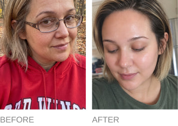 Before and after comparison; individual results may vary